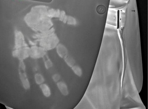 High Performance Radiometric Infrared cameras
