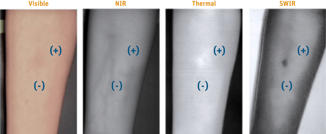 Allergy detection 1