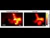 Comparative image reconstructions of a superluminal light wavefrontsweeping